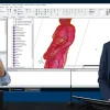 LET'S SIMULATE: IMPLANT HEATING  STAFFEL 1